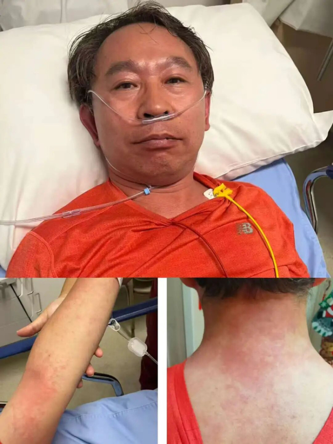 协和专家谭先杰吃头孢过敏进抢救室 生死一线间的惊险经历